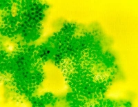 Figure 2 :Colonies de Microcystis (x400)
